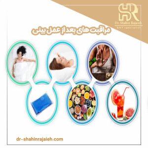 مراقبت های بعد از عمل بینی - دکتر شاهین رجائیه