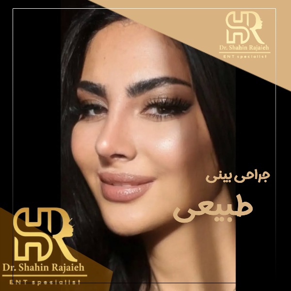 جراحی بینی طبیعی