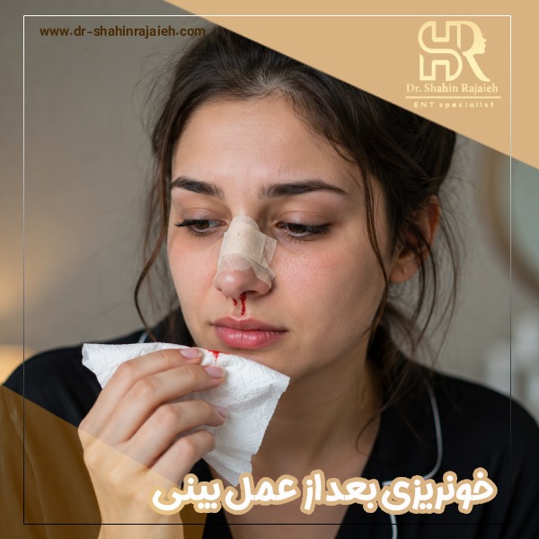 خونریزی بعد از عمل بینی