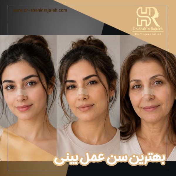 بهترین سن برای عمل بینی
